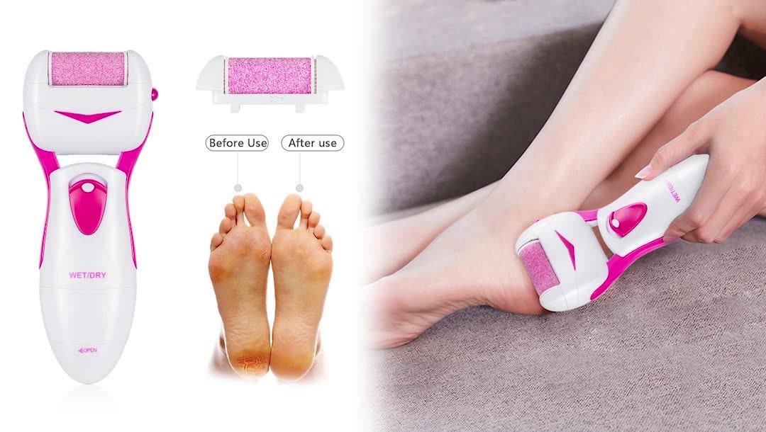 Chinese Foot Pedicure Machine Electric Callus Remover Foot Files For Feet As Seen On Tv Buy