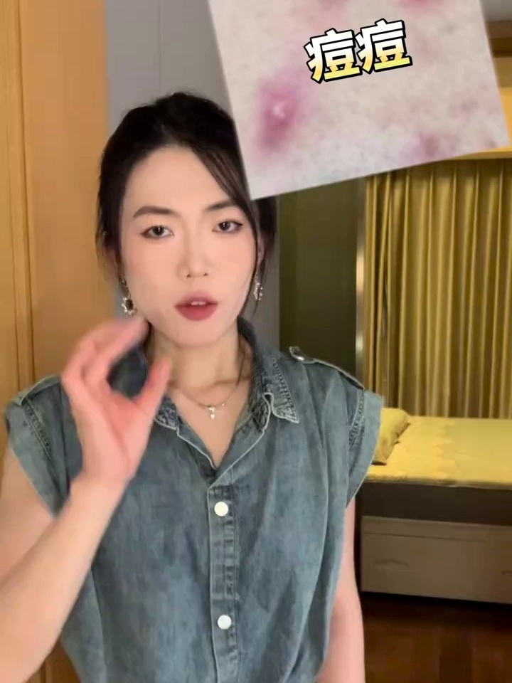 换季痘痘肌救星！华熙生物BM肌活控油乳液确实在值得买吗？