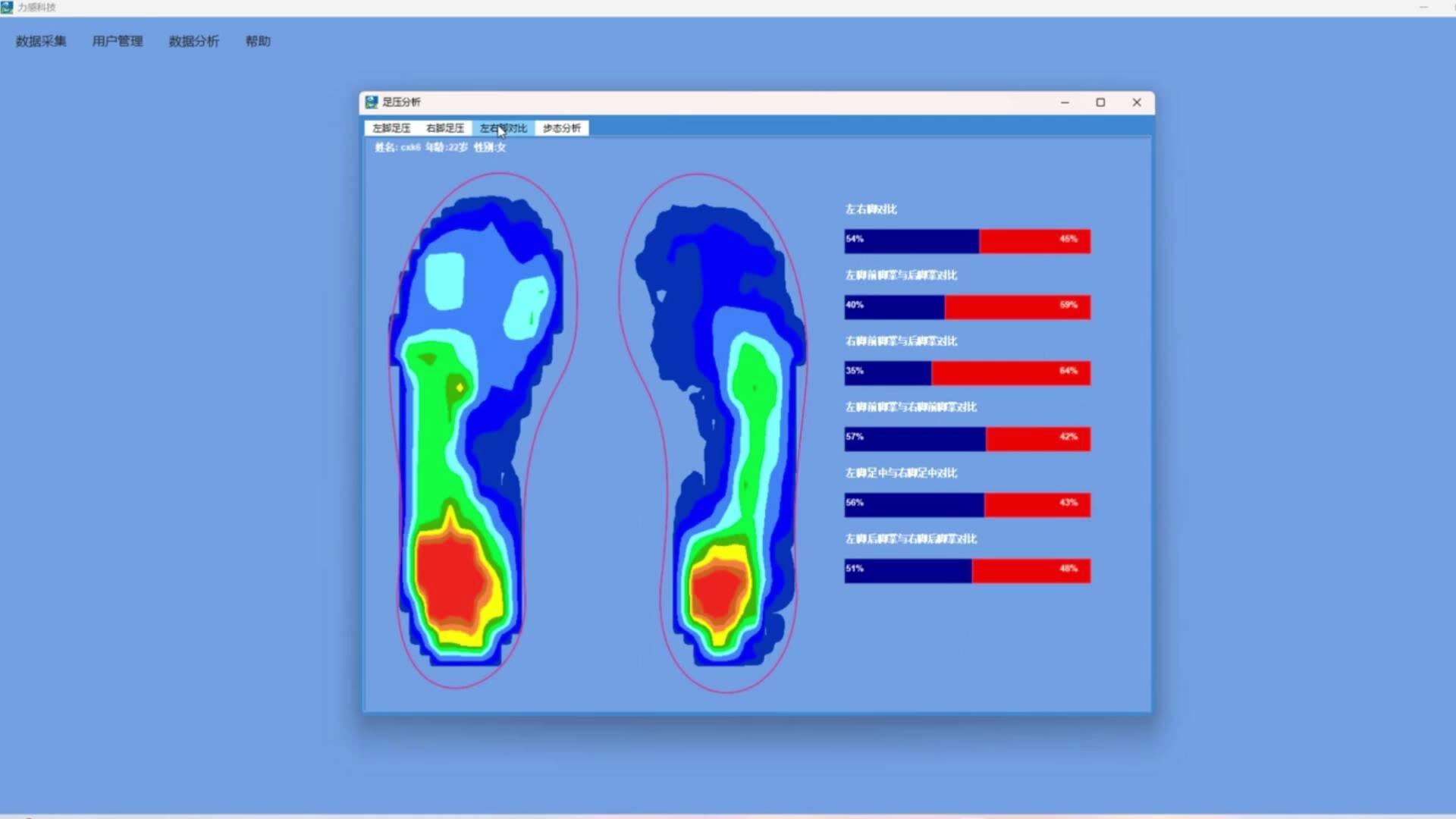 Force Sensing Resistor Multizone 99zone Plantar Pressure Distribution