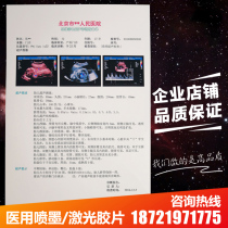 Medical film A4 porcelain white inkjet color ultrasound four-dimensional B super translucent laser dry film printing paper