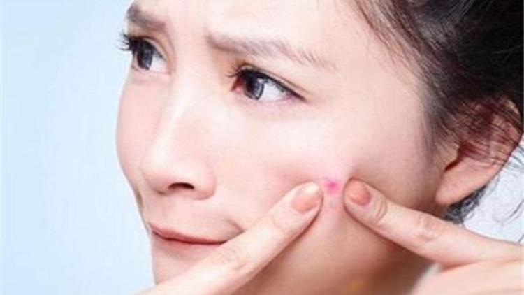 如何干掉“闭口”这个小妖精?好物种草!