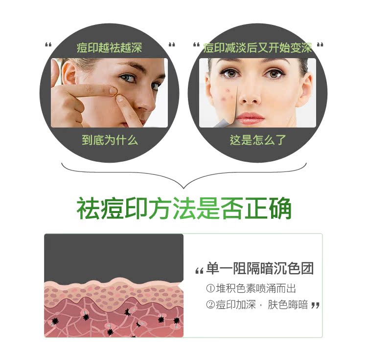 Nhắc lại cỏ đích thực kem trị mụn in mụn mụn trứng cá mụn trứng cá sửa chữa mụn lô hội kem dưỡng kiehl's