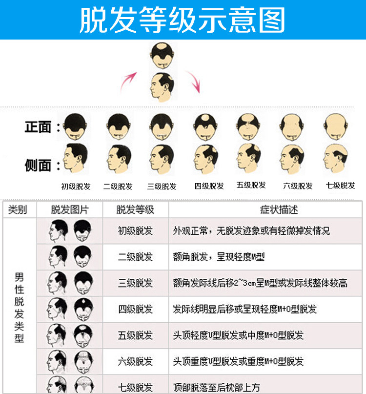 Extension mèches - Ref 224164 Image 17