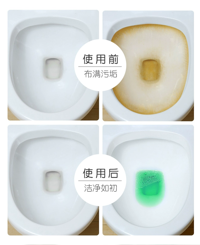 Net An Green Bubble toilet Bao hộ vệ sinh hộ gia đình Ngoài bụi bẩn tiết niệu Hương giun đặc biệt 16 miếng - Trang chủ