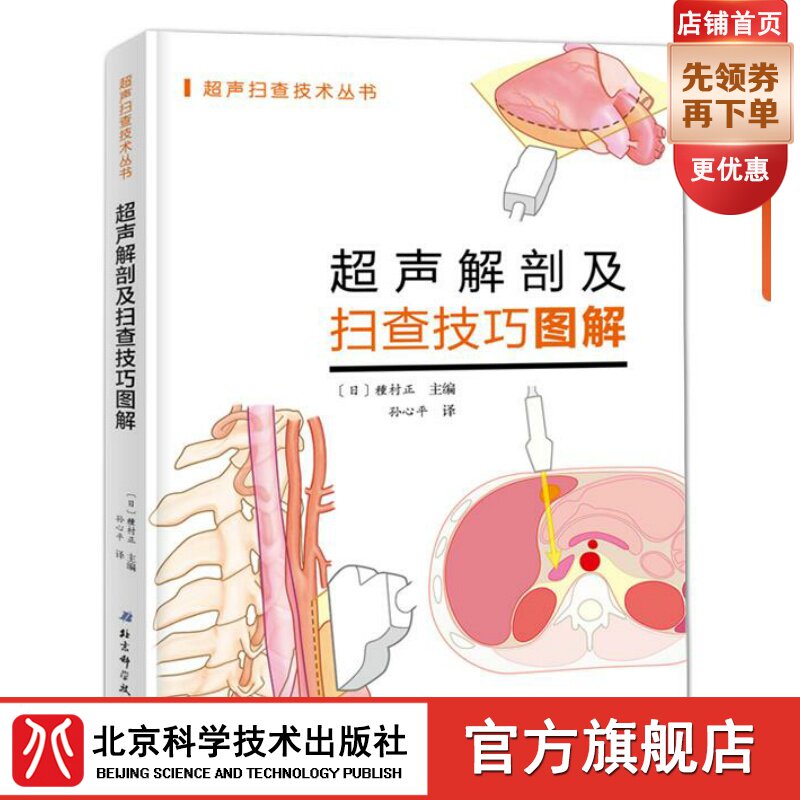Ultrasonic Anatomy and Sweeping Techniques Diagrams Solutions New Hands Starter ultrasonic base Practical operation Beijing Science and Technology Press Spot