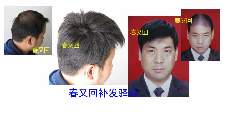 Extension cheveux - Ref 224272 Image 10