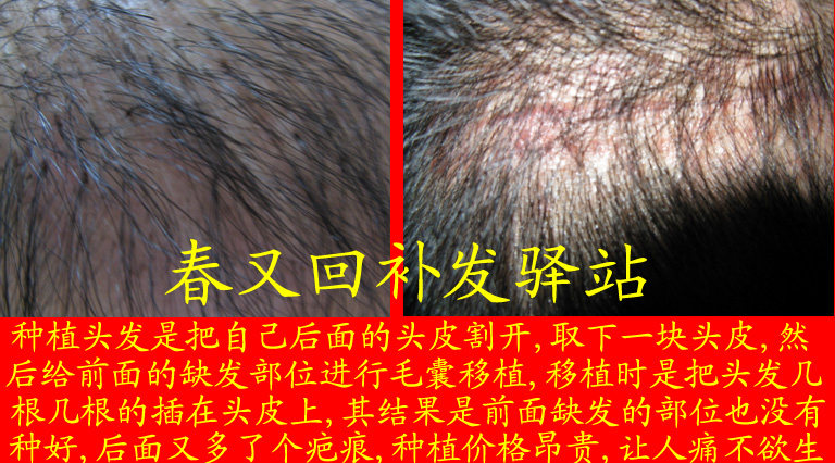 Extension cheveux - Ref 224272 Image 18