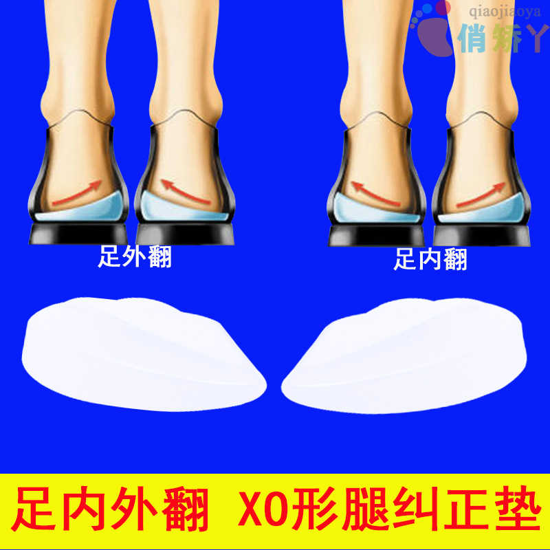 O型腿矫正垫儿童x腿修正器足内外翻重力调节垫小腿外扩内八字鞋垫