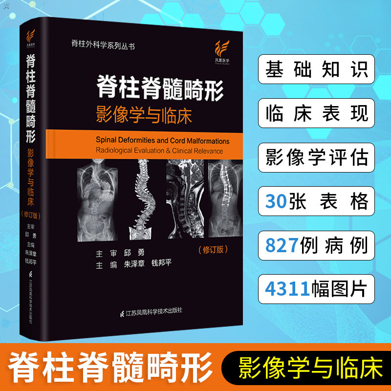 Spine And Spinal Cord Malformation Imaging And Clinical Spine And Spinal Cord Malformation Spine And Limbs Imaging Diagram Spine Imaging Diagnostics Spine Surgery Spine Correction Scoliosis Treatment Spine Books Medical Imaging Diagnostics