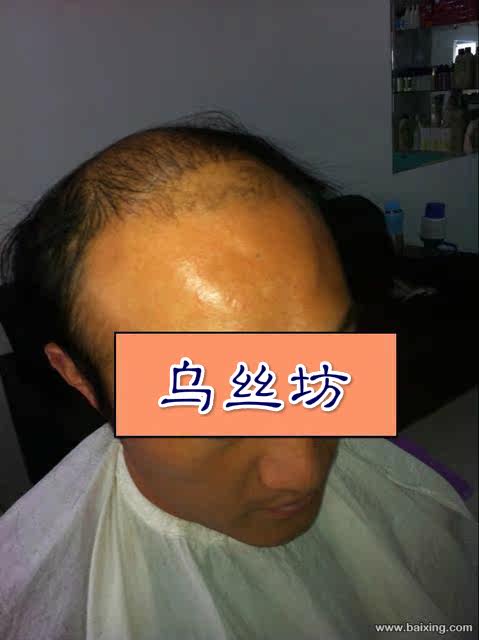 Extension cheveux - Ref 225416 Image 37