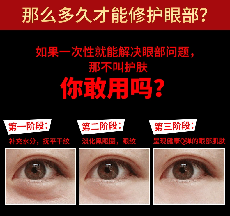 Kem dưỡng mắt Goff Men Eye Eye To Eye Eye Desalination Dark Circle Eye Eye Fine Fine Vitality Firming Eye Cream 20g