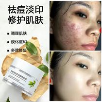 Acne-removing pimples to pimple pimples Pimple Pimple Pit Repair God water Acne Acne Product Face Cream Men Schoolgirls
