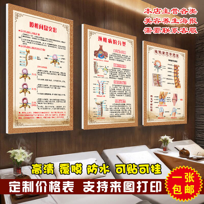 Cervical Spereal Poster Wealthy Backshoulder Peripheral Disc Osteoporosteoporosis Wall Pain Pain Pain Pain