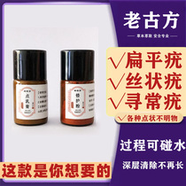 Go to wart ointment Flat Warts Filamentous Gods Face Part neck neck special to clear wart cream to dispel meat sprints