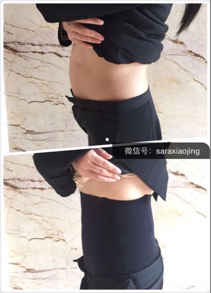 Body - Ref 647472 Image 21