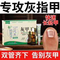 Nail fungus special liquid Sterilization antibacterial soft nail decongestant Removal thickening toe treatment special medicine Glacial acetic acid