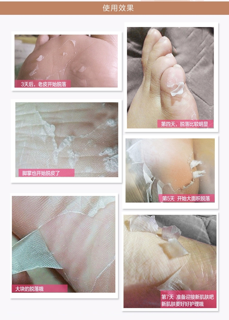 Một cặp lột chân phim tẩy tế bào chết tuổi sừng chân foot mask set dịu mắt cá chân chăm sóc bàn chân cao dán chân