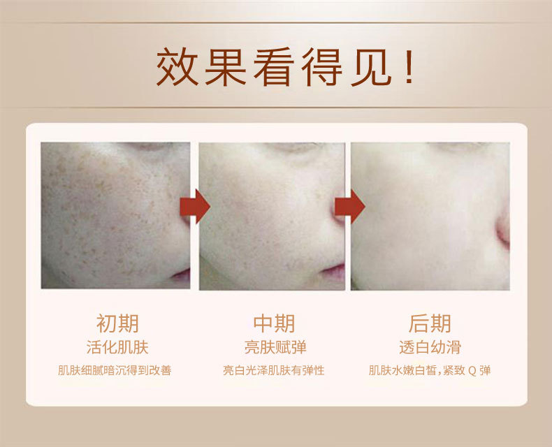 DR.senADE Lady Cream Beauty Cream Pearl Cream - Kem dưỡng da kem dưỡng ẩm hada labo