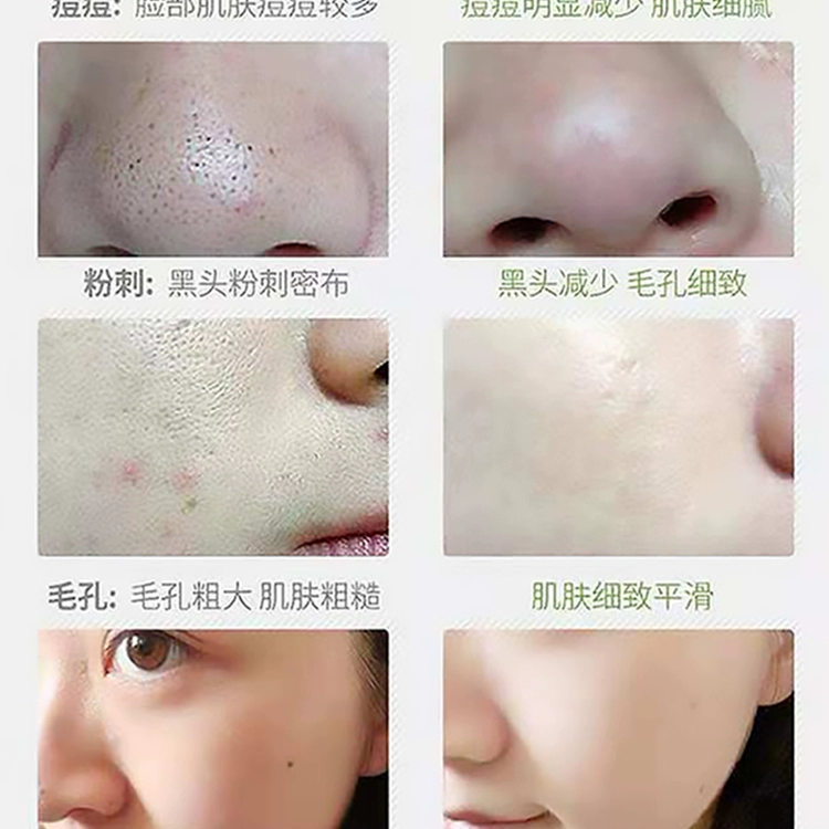 Kem massage làm sạch sâu da làm sạch lỗ chân lông Kem làm sạch da mặt thải chất thải độc tố làm đẹp chuyên dụng