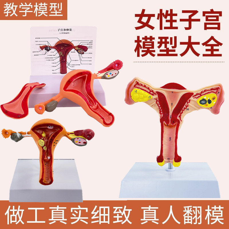 子宫卵巢病理病变模型 生殖科计划生育宣传教具模型 女性生殖解剖