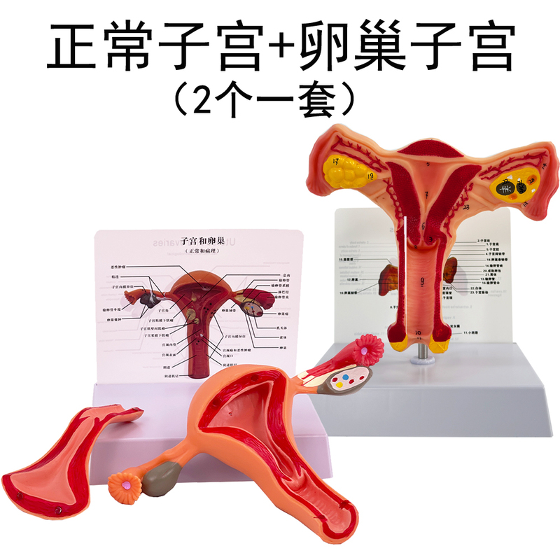 Medical Female Uterus Model Ovary Reproductive Structure Anatomy Model Gynecology Obstetrics Ovary Uterus Model