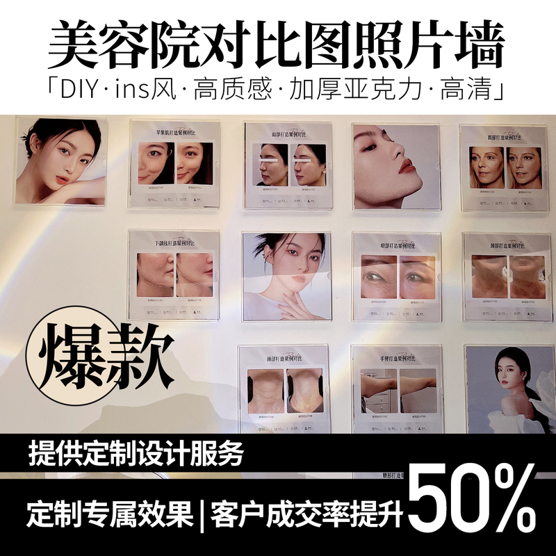 Instagram-Style Photo Wall Acrylic Display Board High-Definition Fashion Art Company Culture Wall Advertising Display