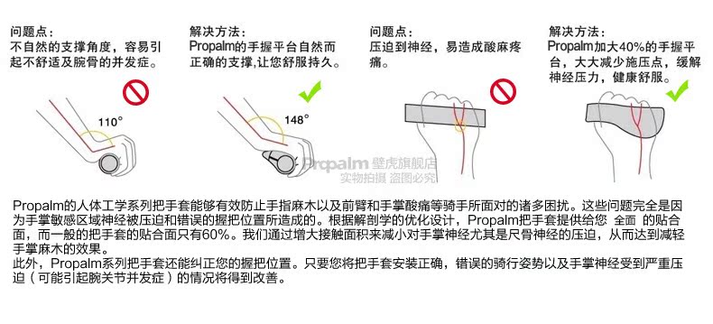 Poignées de vélo PROPALM - Ref 2352356 Image 6