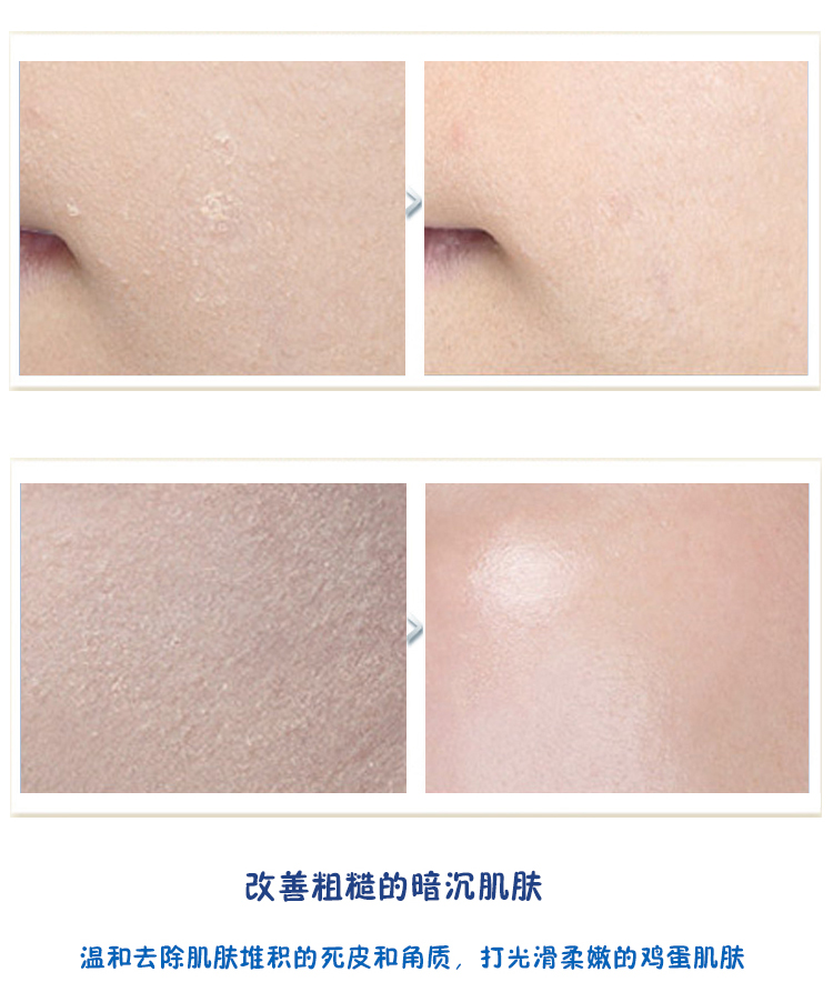 Authentic Korea AHC B5 hyaluronic acid sữa rửa mặt dưỡng ẩm làm sạch sâu lỗ chân lông sữa rửa mặt rice milk