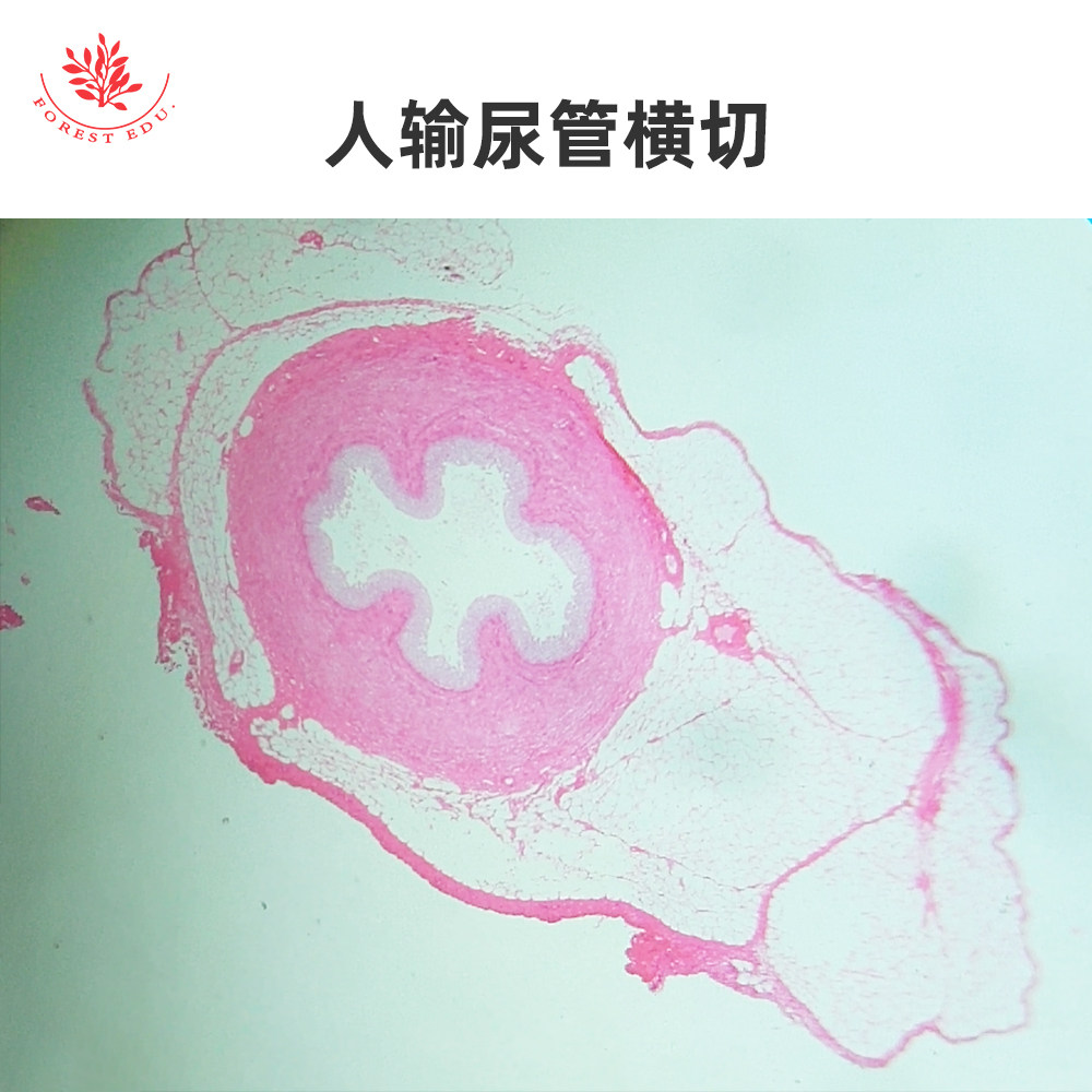 人体泌尿系统组织显微玻片人输尿管横切变移上皮膀胱空虚时扩张时