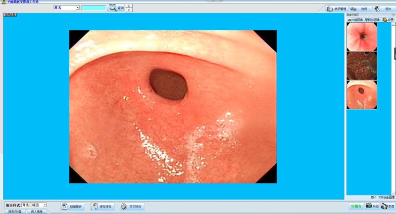 Gastrointestinal endoscopy imaging workstation