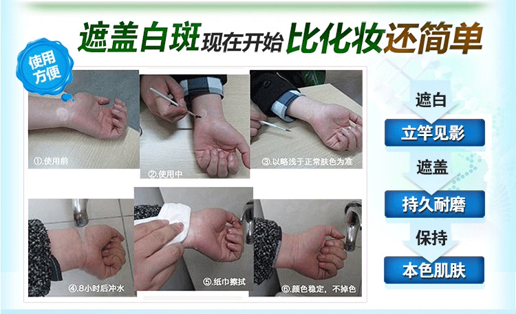 Y tế Meilin màu xanh lá cây hạt nhân bạch biến bao gồm kem kem kéo dài không thấm nước đốm trắng sửa chữa bên ngoài kem che khuyết điểm bút màu kem nền che khuyết điểm hàn quốc