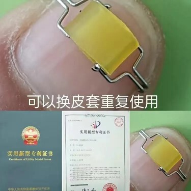 Paronychia Ingrown Toenail Corrector Nail Correction Patch Nail Buckle Nail Corrector Paronychia Correction Patch Nail Correction