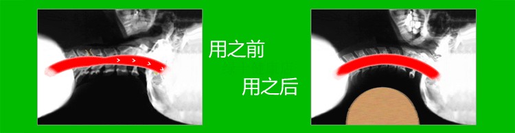 Gối gỗ tự nhiên sửa chữa lực kéo tự nhiên sửa chữa cong cổ tử cung đăng nhập cổ gối hình trụ sức khỏe gối cứng gối cao su kim cương
