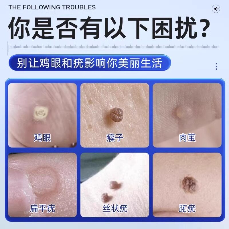 告别脚底烦恼,海氏海诺鸡眼疣护理盒贴,轻松搞定肉刺跖疣!👣 -创口贴-淘宝百科网
