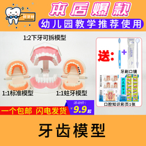  Dental tooth model Childrens early education brushing practice Oral teaching denture model Kindergarten teaching brushing model