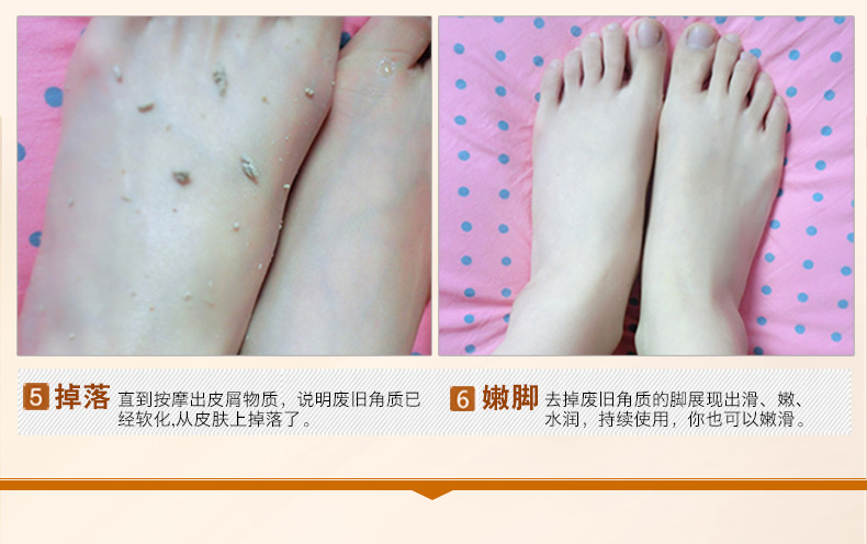 Flute tình yêu chân chà tẩy tế bào chết kem để chết da callus chăm sóc bàn chân chân phim chống khô kem massage ủ lột da chân