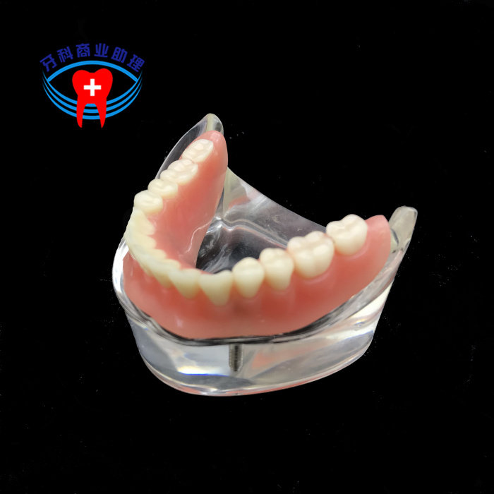 Dental implant body repair model half-mouth planting nail polo cap combined with covered denture planting and repair teaching-Taobao