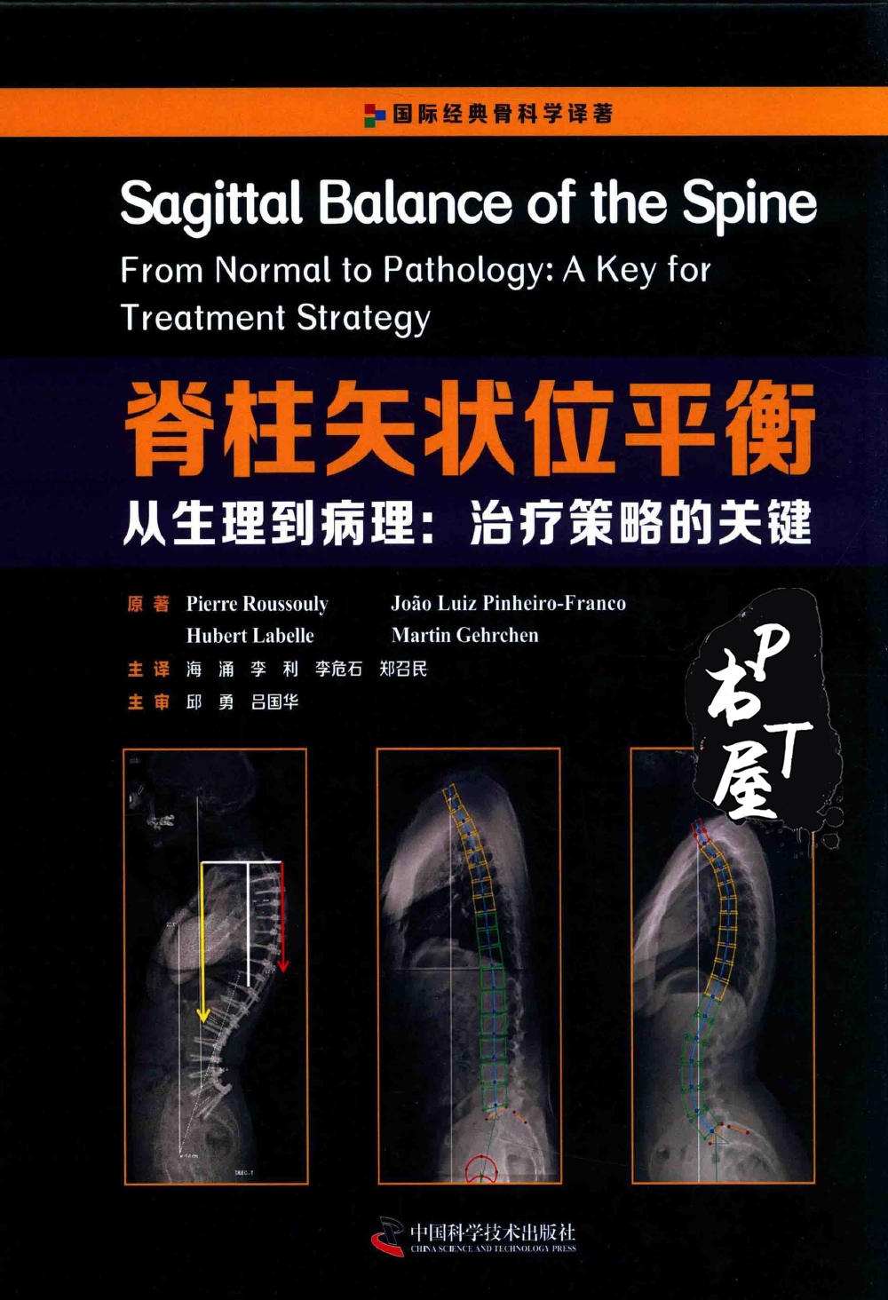 脊柱矢状位平衡 Book Cover