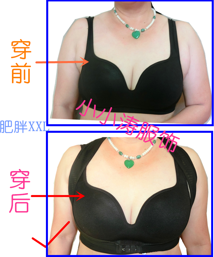 Đồ lót khắc phục chỉnh hình corset chức năng ngực hỗ trợ ngực bộ sưu tập phó sữa cơ thể nhựa áo sơ mi thẳng lại ngực ngực nhựa corset