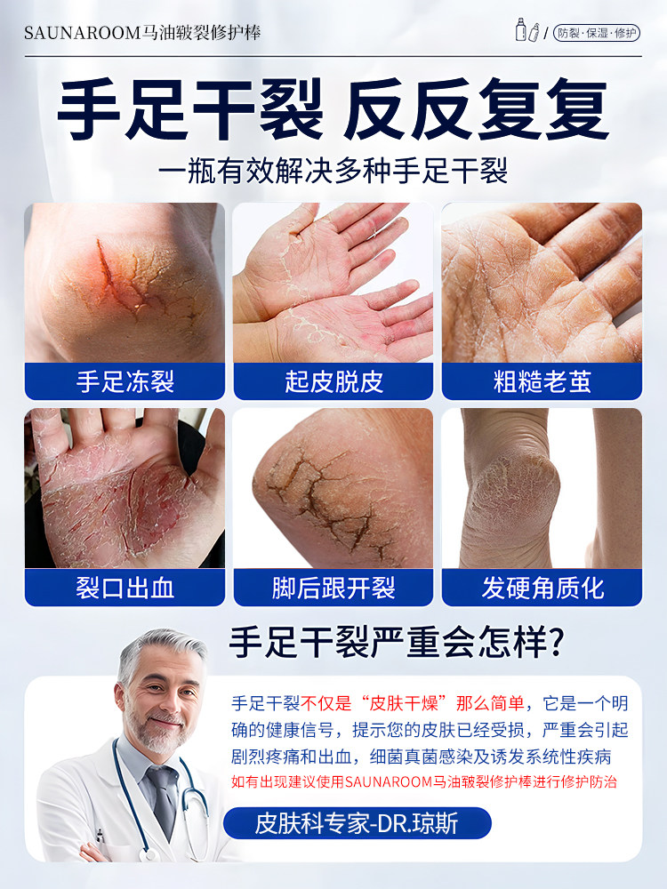 Cracked Heels with Hard Skin, Cracked and Chapped Heels, Horse Oil Ointment to Repair Hands and Feet, Moisturizing and Nourishing Foot Cream for Winter