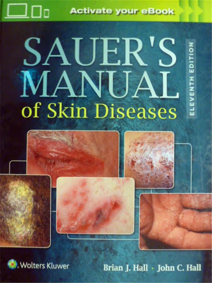 English version of Sauers Manual of Skin Diseases Skin Disease handbook