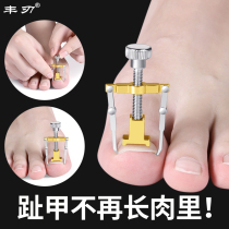 Embedded nail corrector Toenail pull patch Foot nail corrector Nail grows into the flesh Embedded nail groove corrector inflammation