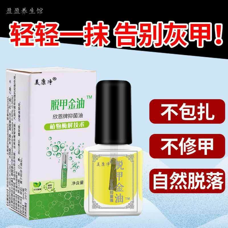 Meikangjing gray nail bacteriostatic liquid nail removal gold oil Meikangjing nail removal essential oil Xinen brand bacteriostatic oil
