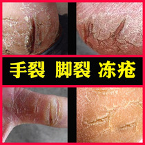 Read Kirin Skin Care Cream Inexhaustible Hand Foot Dry Cleft Heel Cracked heel Anti-crack cream Crack Candida repair paste Anti-frost cream