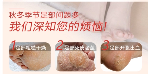 Японское увлажняющее отбеливающее масло для ног, отшелушивающие напяточники против мозолей, содержит лошадиное масло, пилинг, против трещин