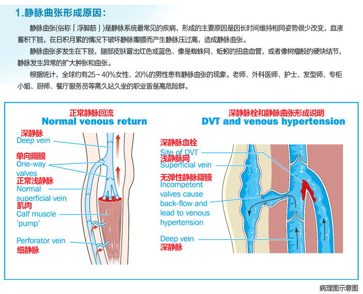 Chaussettes - collants Calf manchon - Ref 772135 Image 11