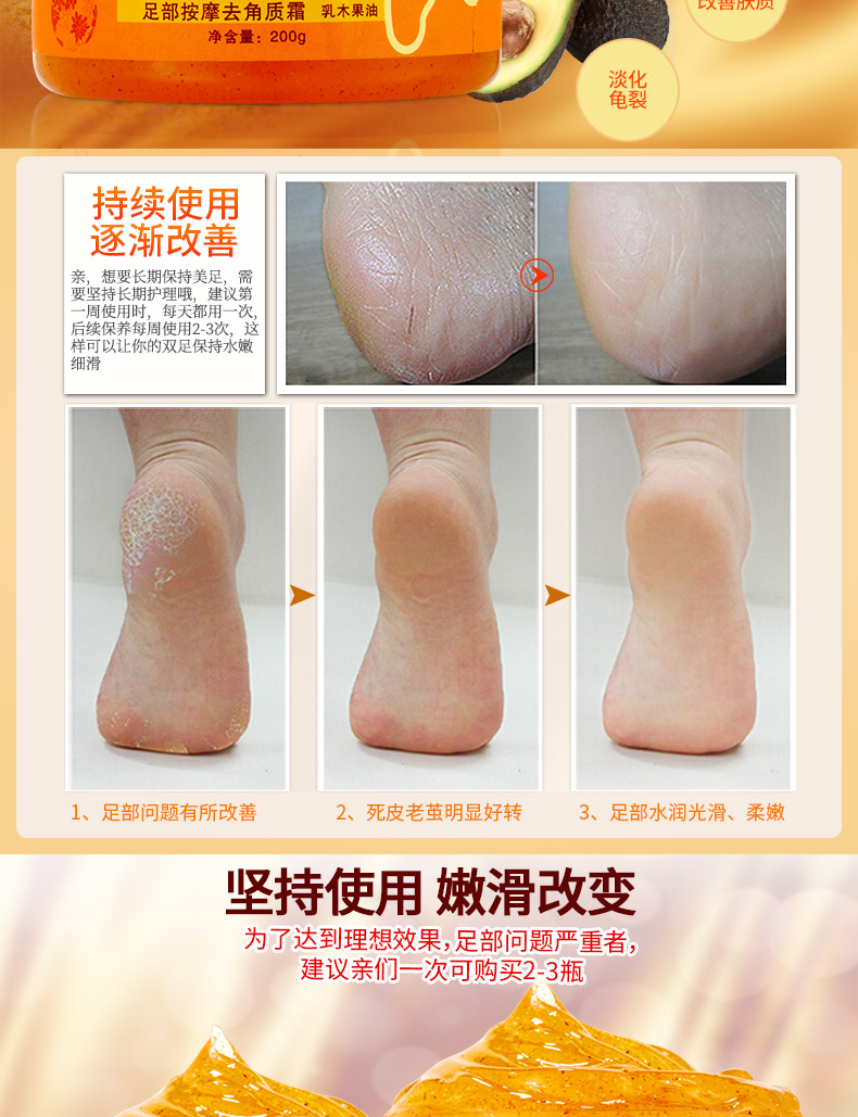 Chân tẩy tế bào chết kem để chết da chân dịu dàng bàn chân đẹp chăm sóc bàn chân cũ làm trắng chân mặt nạ gel chà tẩy da chết gót chân