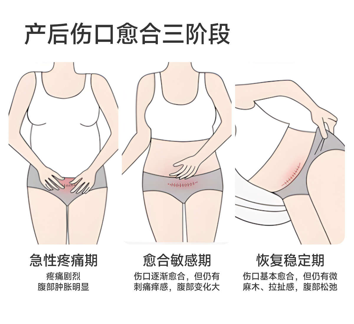 JQ婧麒产后高腰内裤纯棉不磨刀疤加长裆收腹月子期剖腹产专用内裤 — 5