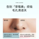 Meiwan Visual Blackhead Sucker Electric высасывает артефакт Blackhead, маленькие поры с воздушным пузырьком, чтобы очистить дом для красоты дома