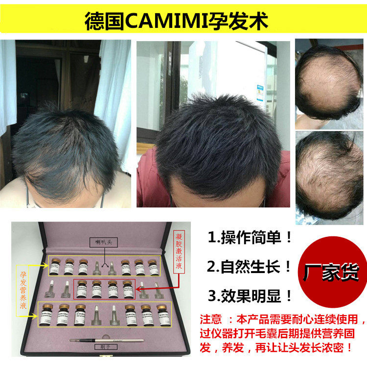 German caimimi pregnant eyebrow pregnancy hair growth liquid set box pregnant eyebrow pregnancy hair growth liquid semi-permanent fast eyebrow fast hair surgery